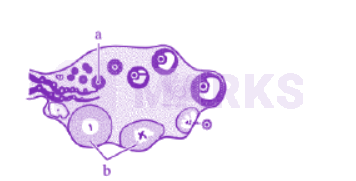 NEET 2013 Zoology, Human Reproduction — question figure