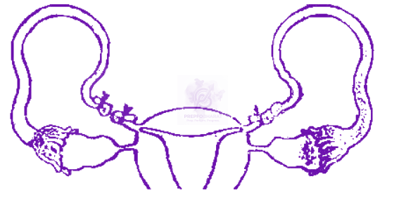 NEET 2012 Zoology, Reproductive Health — question figure