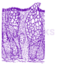 NEET 2012 Zoology, Structural Organisation in Animals — question figure 2